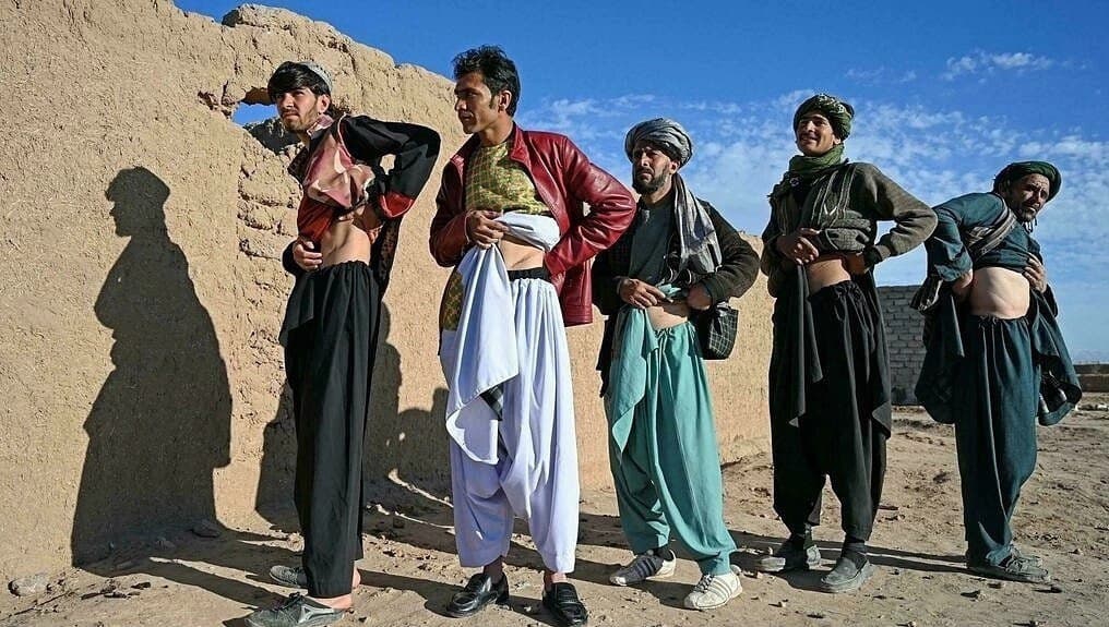 Ngôi làng “một thận” tại quốc gia hồi giáo Afghanistan  