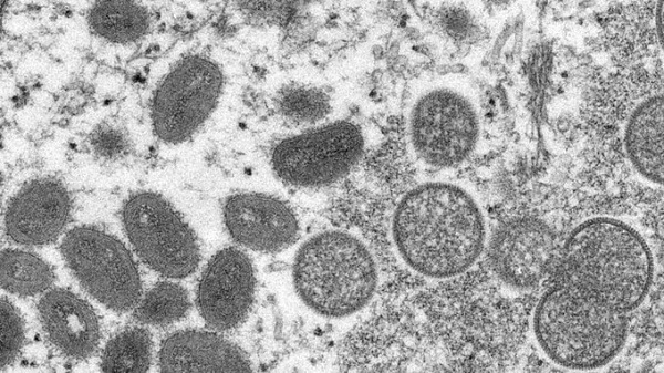 Enzym khiến virus đậu mùa khỉ đột biến 